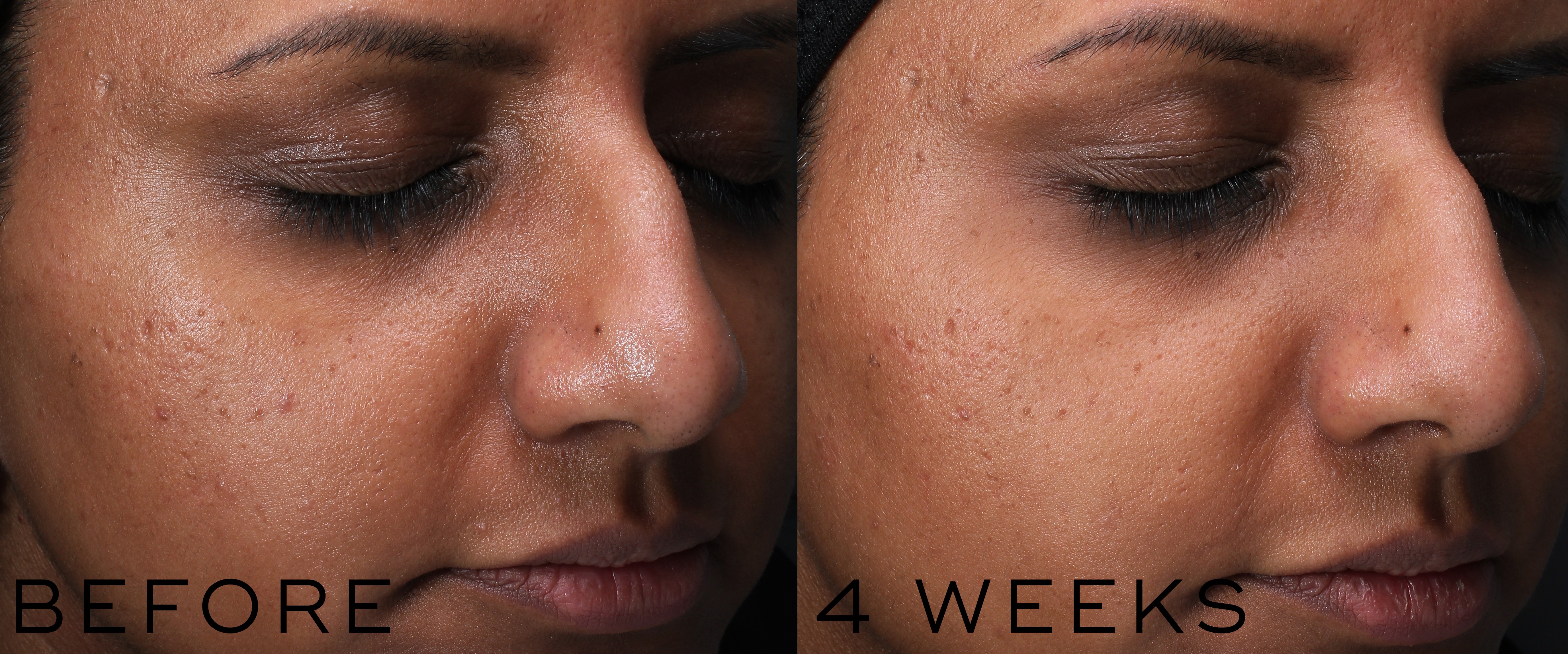 medik8 clarity peptide